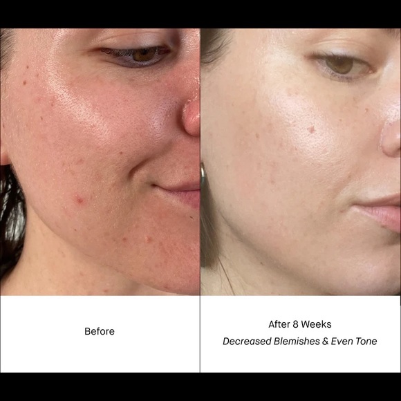 Shani Darden Retinol Reform Serum - Picture 7 of 9